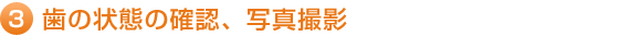 3.歯の状態の確認、写真撮影